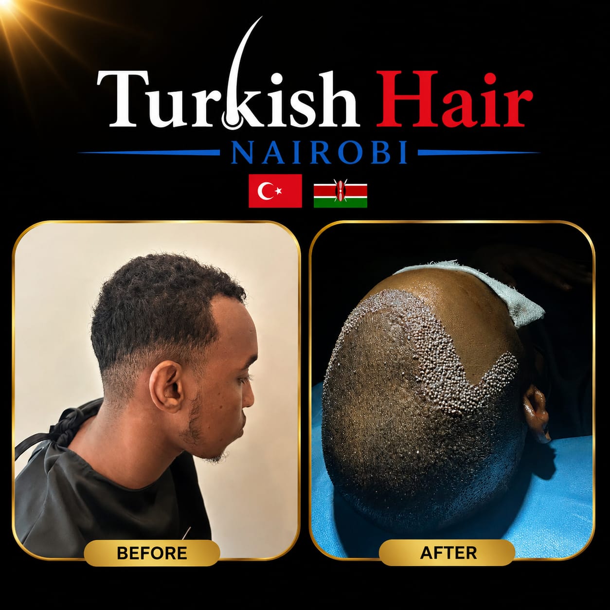Turkish Hair Nairobi Case 11